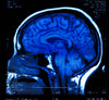 Trauma and the Brain: Actionable Neuroscience for Stress, Anxiety and Trauma # 19 Aug 2025 # LIVE, Online, Interactive Workshop #